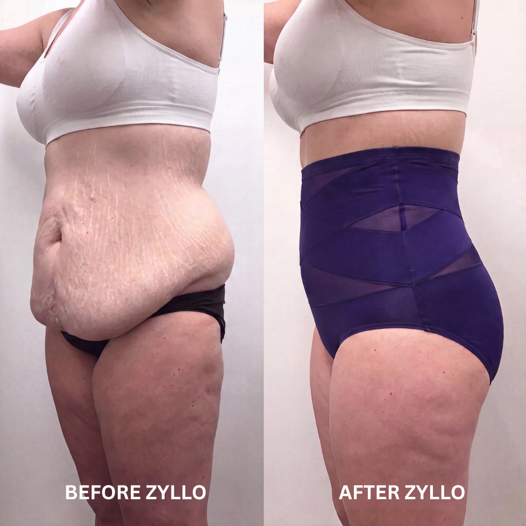 Zyllo™ High-Waisted Shaping Brief